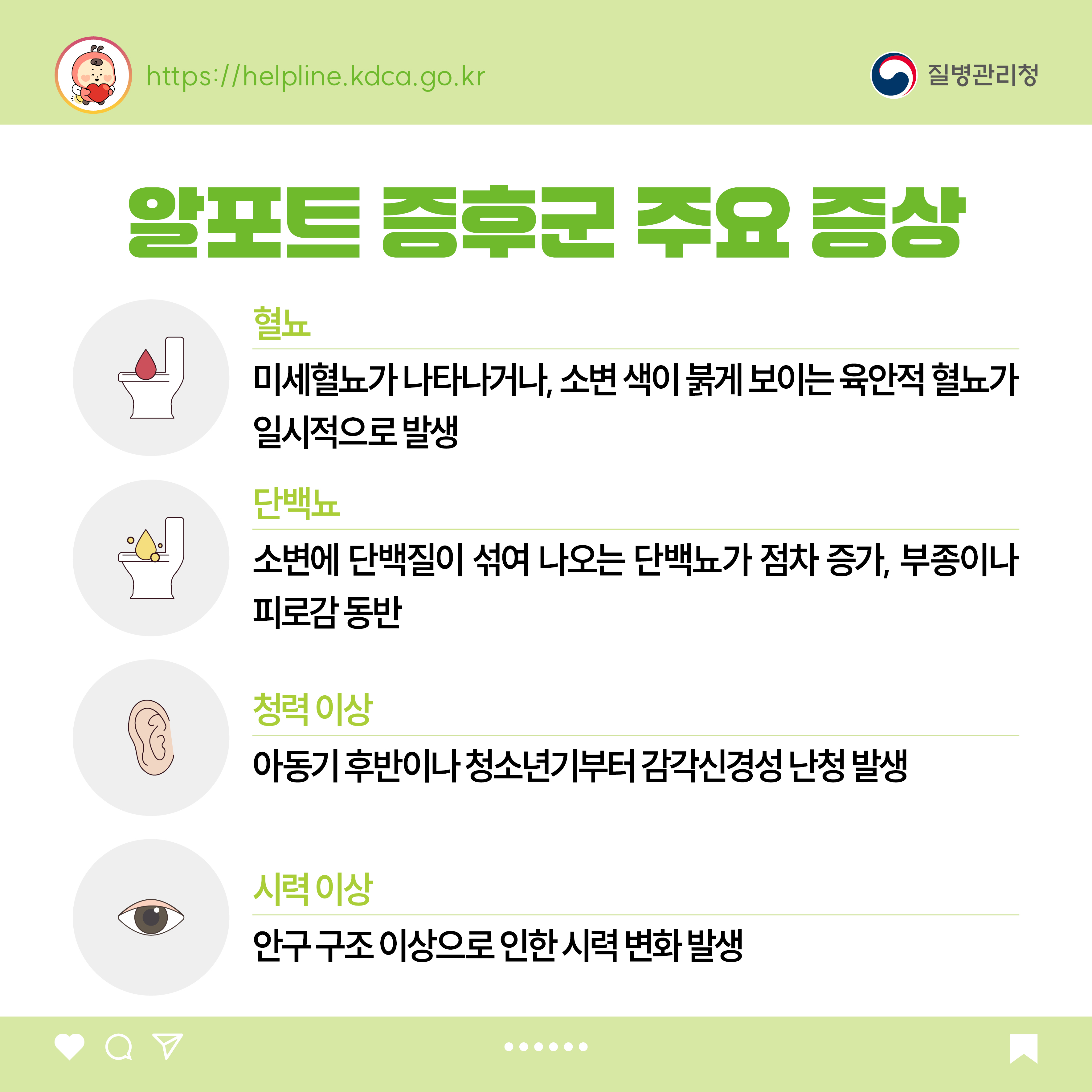 알포트 증후군 주요 증상  - 혈뇨: 미세혈뇨가 나타나거나, 소변 색이 붉게 보이는 육안적 혈뇨가 일시적으로 발생 - 단백뇨: 소변에 단백질이 섞여 나오는 단백뇨가 점차 증가, 부종이나 피로감 동반 - 청력 이상: 아동기 후반이나 청소년기부터 감각신경성 난청 발생 - 시력 이상: 안구 구조 이상으로 인한 시력 변화 발생